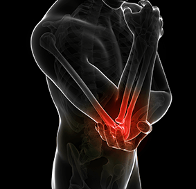 Viscosupplementation for Elbow Arthritis