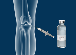 Combined Hyaluronic Therapy for the Knee