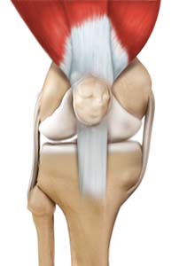 Knee Ligament Reconstruction