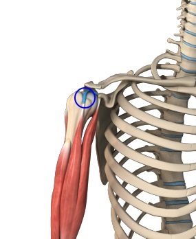 Long Head Biceps Tendon Rupture