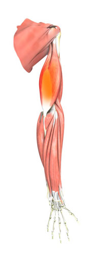 Triceps Tendonitis